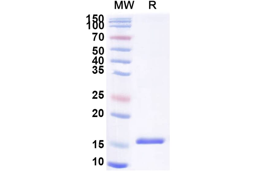SDS-PAGE - Anti-SARS-CoV-2 Spike Protein Nanobody [SAA0893] (A338017) - Antibodies.com