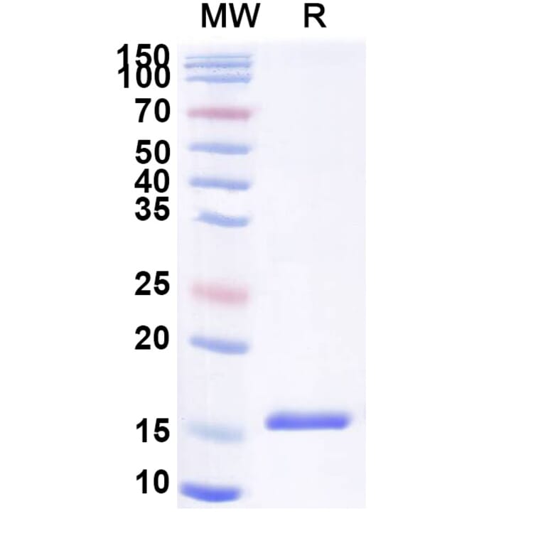 SDS-PAGE - Anti-SARS-CoV-2 Spike Protein Nanobody [SAA0893] (A338017) - Antibodies.com