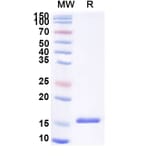 SDS-PAGE - Anti-SARS-CoV-2 Spike Protein Nanobody [SAA0893] (A338017) - Antibodies.com