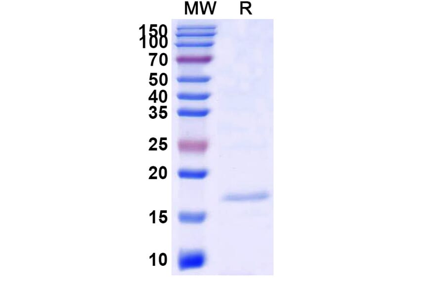 SDS-PAGE - Anti-SARS-CoV-2 Spike Protein Nanobody [SAA0909] (A338018) - Antibodies.com