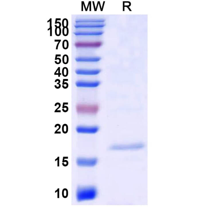 SDS-PAGE - Anti-SARS-CoV-2 Spike Protein Nanobody [SAA0909] (A338018) - Antibodies.com
