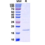 SDS-PAGE - Anti-SARS-CoV-2 Spike Protein Nanobody [SAA0909] (A338018) - Antibodies.com