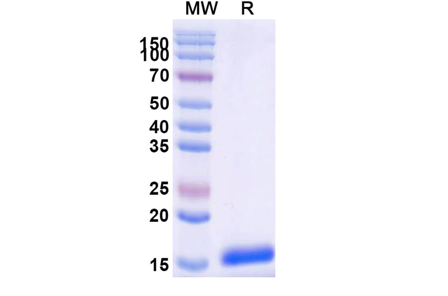 SDS-PAGE - Anti-SARS-CoV-2 Spike Protein Nanobody [SAA0910] (A338019) - Antibodies.com