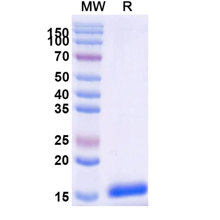 SDS-PAGE - Anti-SARS-CoV-2 Spike Protein Nanobody [SAA0910] (A338019) - Antibodies.com