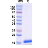 SDS-PAGE - Anti-SARS-CoV-2 Spike Protein Nanobody [SAA0910] (A338019) - Antibodies.com