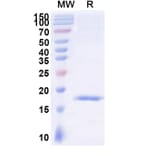 SDS-PAGE - Anti-SARS-CoV-2 Spike Protein Nanobody [SAA0911] (A338020) - Antibodies.com