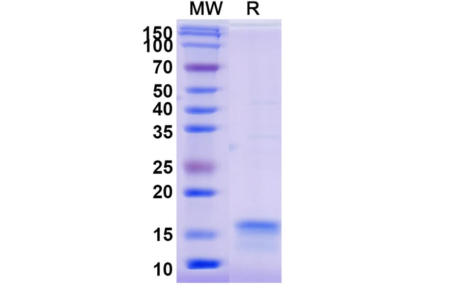 SDS-PAGE - Anti-SARS-CoV-2 Spike Protein Nanobody [SAA0913] (A338021) - Antibodies.com