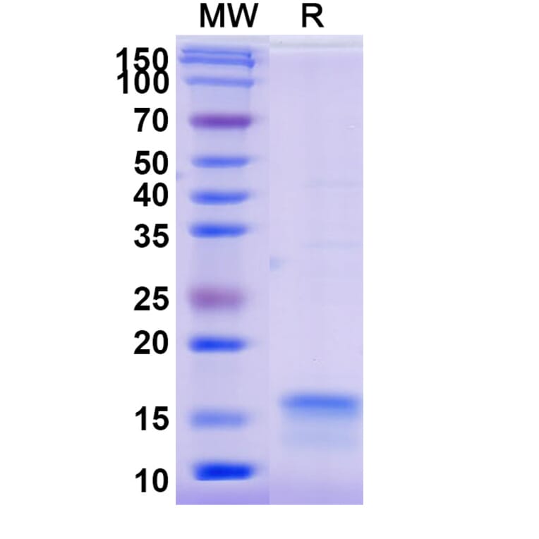 SDS-PAGE - Anti-SARS-CoV-2 Spike Protein Nanobody [SAA0913] (A338021) - Antibodies.com