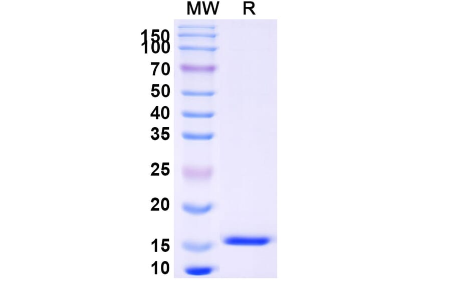 SDS-PAGE - Anti-SARS-CoV-2 Spike Protein Nanobody [SAA0915] (A338023) - Antibodies.com