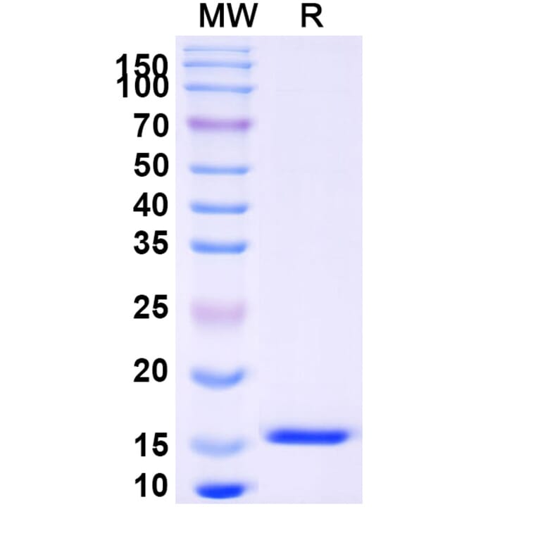 SDS-PAGE - Anti-SARS-CoV-2 Spike Protein Nanobody [SAA0915] (A338023) - Antibodies.com