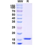 SDS-PAGE - Anti-SARS-CoV-2 Spike Protein Nanobody [SAA0915] (A338023) - Antibodies.com