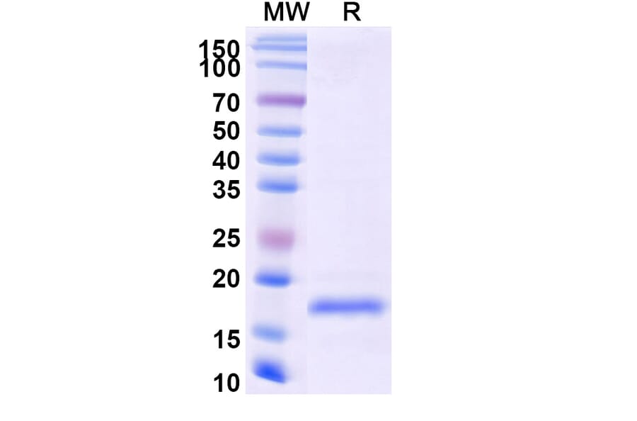 SDS-PAGE - Anti-SARS-CoV-2 Spike Protein Nanobody [SAA0916] (A338024) - Antibodies.com
