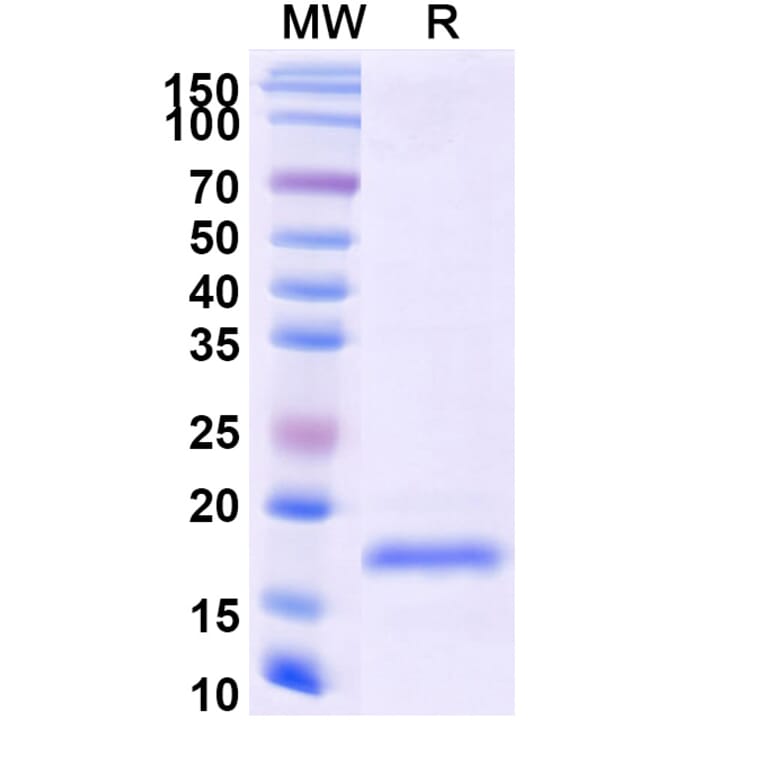 SDS-PAGE - Anti-SARS-CoV-2 Spike Protein Nanobody [SAA0916] (A338024) - Antibodies.com