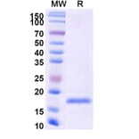SDS-PAGE - Anti-SARS-CoV-2 Spike Protein Nanobody [SAA0916] (A338024) - Antibodies.com