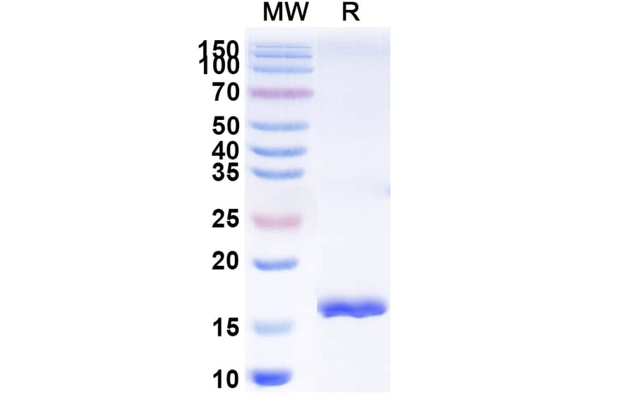 SDS-PAGE - Anti-SARS-CoV-2 Spike Protein Nanobody [SAA0944] (A338026) - Antibodies.com
