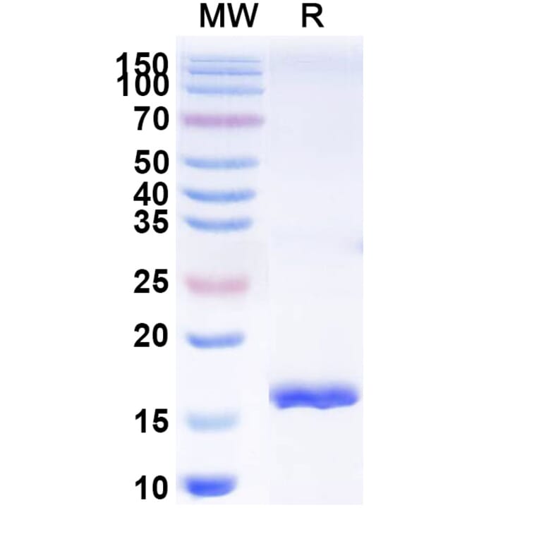 SDS-PAGE - Anti-SARS-CoV-2 Spike Protein Nanobody [SAA0944] (A338026) - Antibodies.com