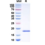 SDS-PAGE - Anti-SARS-CoV-2 Spike Protein Nanobody [SAA0945] (A338027) - Antibodies.com
