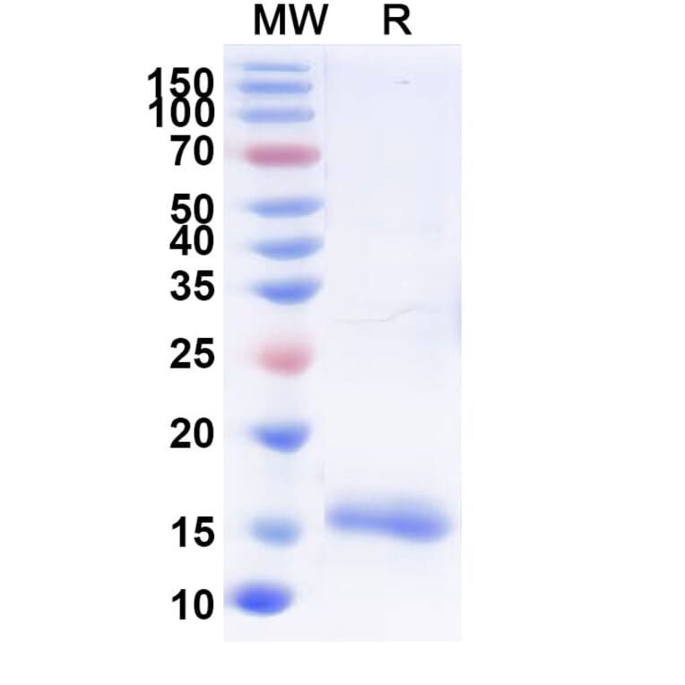 SDS-PAGE - Anti-SARS-CoV-2 Spike Protein Nanobody [SAA0946] (A338028) - Antibodies.com