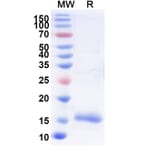 SDS-PAGE - Anti-SARS-CoV-2 Spike Protein Nanobody [SAA0946] (A338028) - Antibodies.com