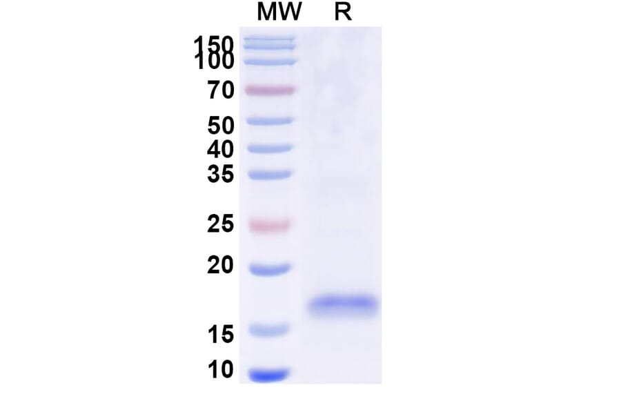 SDS-PAGE - Anti-SARS-CoV-2 Spike Protein Nanobody [SAA0947] (A338029) - Antibodies.com