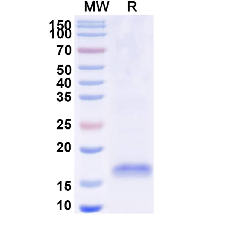 SDS-PAGE - Anti-SARS-CoV-2 Spike Protein Nanobody [SAA0947] (A338029) - Antibodies.com