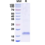 SDS-PAGE - Anti-SARS-CoV-2 Spike Protein Nanobody [SAA0947] (A338029) - Antibodies.com
