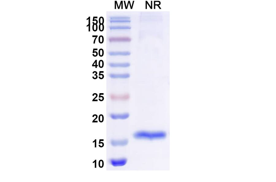 SDS-PAGE - Anti-SARS-CoV-2 Spike Protein Nanobody [SAA0948] (A338030) - Antibodies.com