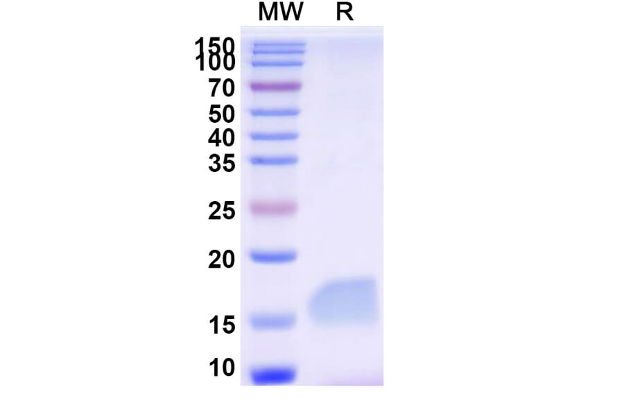SDS-PAGE - Anti-SARS-CoV-2 Spike Protein Nanobody [SAA0949] (A338031) - Antibodies.com