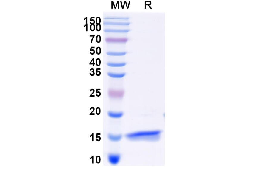 SDS-PAGE - Anti-SARS-CoV-2 Spike Protein Nanobody [SAA0950] (A338032) - Antibodies.com