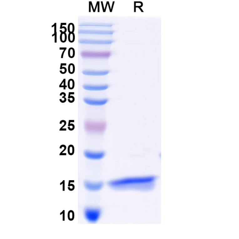 SDS-PAGE - Anti-SARS-CoV-2 Spike Protein Nanobody [SAA0950] (A338032) - Antibodies.com