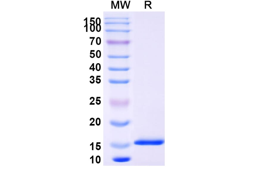 SDS-PAGE - Anti-SARS-CoV-2 Spike Protein Nanobody [SAA0951] (A338033) - Antibodies.com