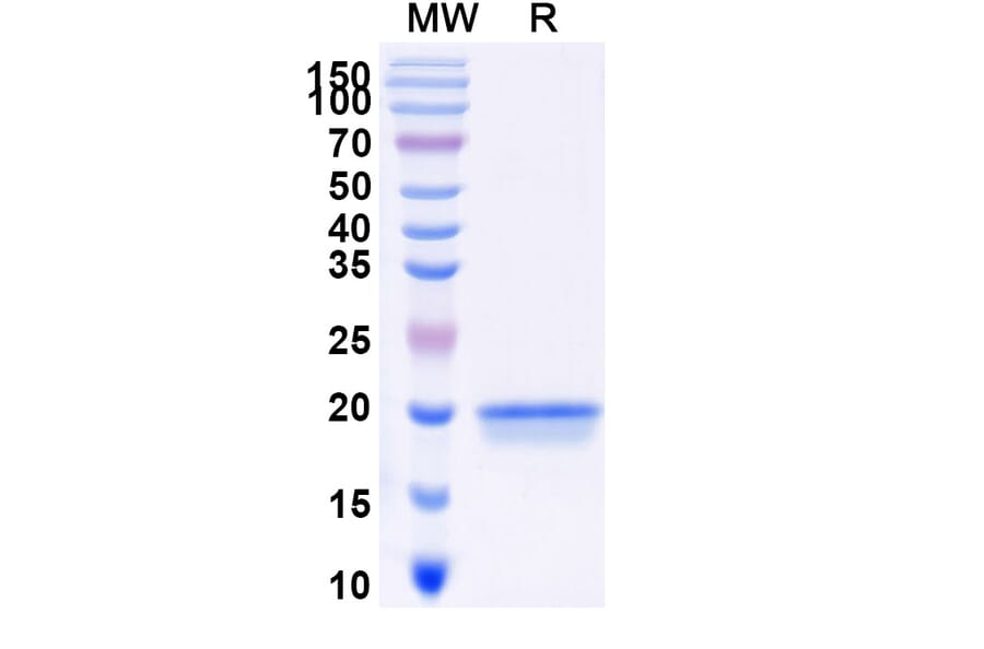 SDS-PAGE - Anti-SARS-CoV-2 Spike Protein Nanobody [SAA0957] (A338036) - Antibodies.com