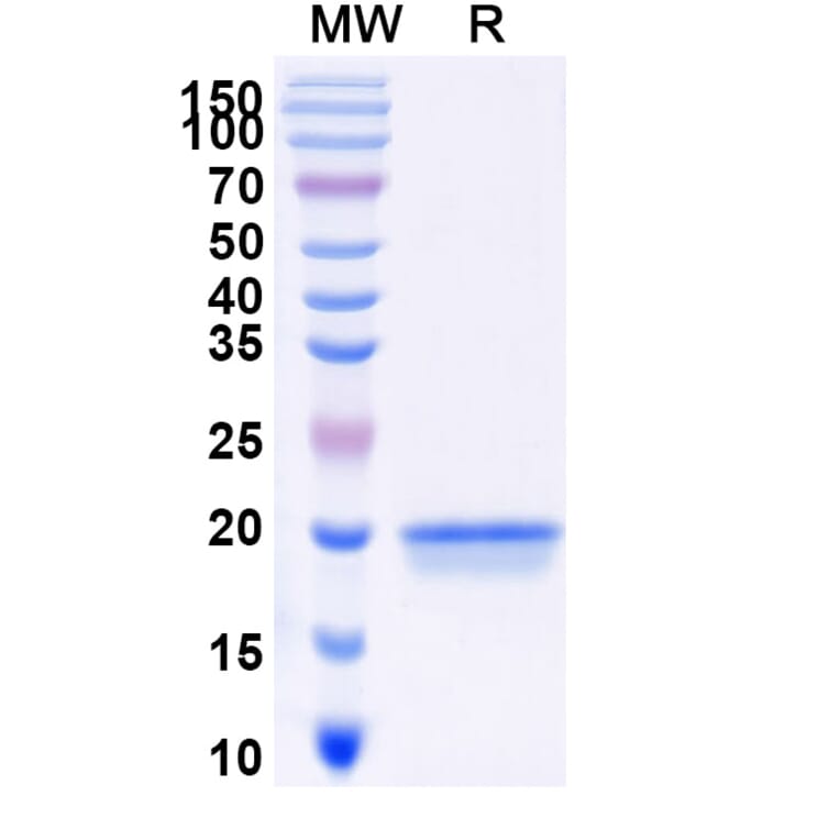 SDS-PAGE - Anti-SARS-CoV-2 Spike Protein Nanobody [SAA0957] (A338036) - Antibodies.com