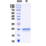 SDS-PAGE - Anti-SARS-CoV-2 Spike Protein Nanobody [SAA0957] (A338036) - Antibodies.com