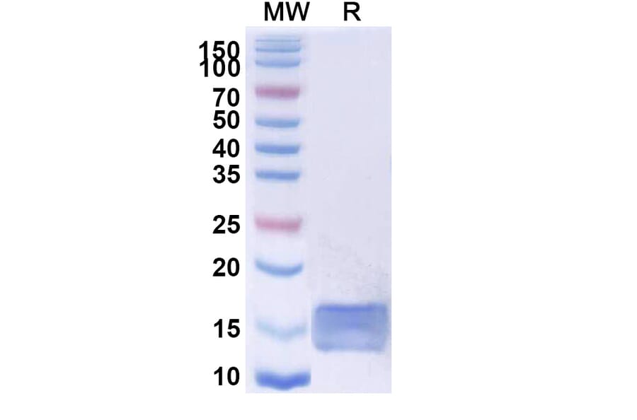 SDS-PAGE - Anti-SARS-CoV-2 Spike Protein Nanobody [SAA0964] (A338037) - Antibodies.com