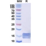 SDS-PAGE - Anti-SARS-CoV-2 Spike Protein Nanobody [SAA0964] (A338037) - Antibodies.com