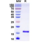 SDS-PAGE - Anti-SARS-CoV-2 Spike Protein Nanobody [SAA0965] (A338038) - Antibodies.com