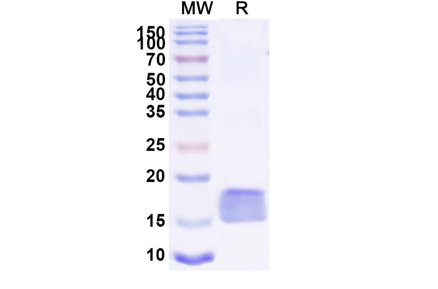 SDS-PAGE - Anti-SARS-CoV-2 Spike Protein Nanobody [SAA0967] (A338039) - Antibodies.com
