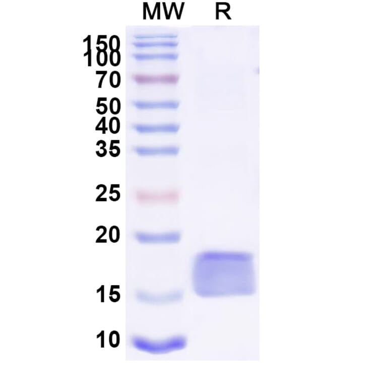 SDS-PAGE - Anti-SARS-CoV-2 Spike Protein Nanobody [SAA0967] (A338039) - Antibodies.com