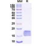 SDS-PAGE - Anti-SARS-CoV-2 Spike Protein Nanobody [SAA0967] (A338039) - Antibodies.com