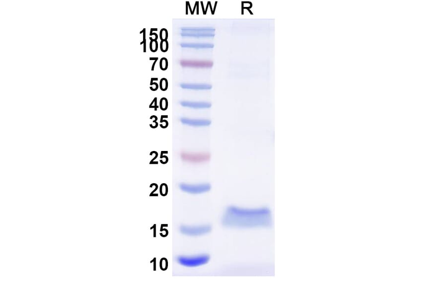 SDS-PAGE - Anti-SARS-CoV-2 Spike Protein Nanobody [SAA0968] (A338040) - Antibodies.com