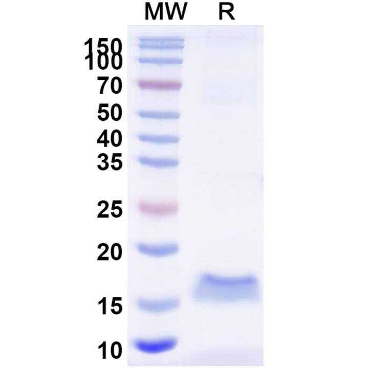 SDS-PAGE - Anti-SARS-CoV-2 Spike Protein Nanobody [SAA0968] (A338040) - Antibodies.com
