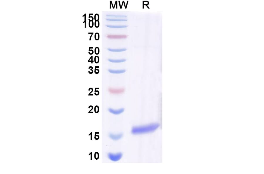 SDS-PAGE - Anti-SARS-CoV-2 Spike Protein Nanobody [SAA0969] (A338041) - Antibodies.com