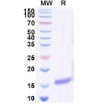 SDS-PAGE - Anti-SARS-CoV-2 Spike Protein Nanobody [SAA0969] (A338041) - Antibodies.com