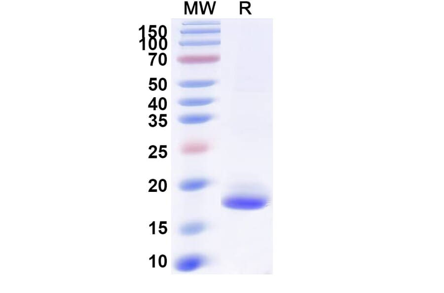 SDS-PAGE - Anti-SARS-CoV-2 Spike Protein Nanobody [SAA0970] (A338042) - Antibodies.com