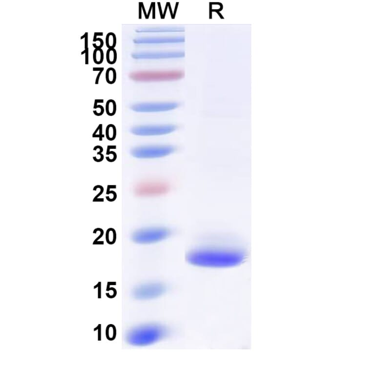 SDS-PAGE - Anti-SARS-CoV-2 Spike Protein Nanobody [SAA0970] (A338042) - Antibodies.com