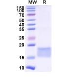 SDS-PAGE - Anti-SARS-CoV-2 Spike Protein Nanobody [SAA0974] (A338043) - Antibodies.com