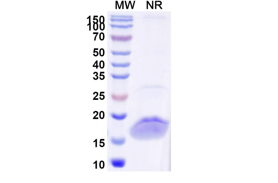 SDS-PAGE - Anti-SARS-CoV-2 Spike Protein Nanobody [SAA0986] (A338044) - Antibodies.com