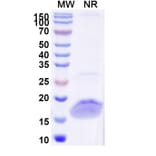 SDS-PAGE - Anti-SARS-CoV-2 Spike Protein Nanobody [SAA0986] (A338044) - Antibodies.com