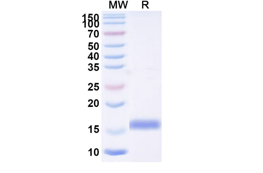 SDS-PAGE - Anti-SARS-CoV-2 Spike Protein Nanobody [SAA0989] (A338046) - Antibodies.com